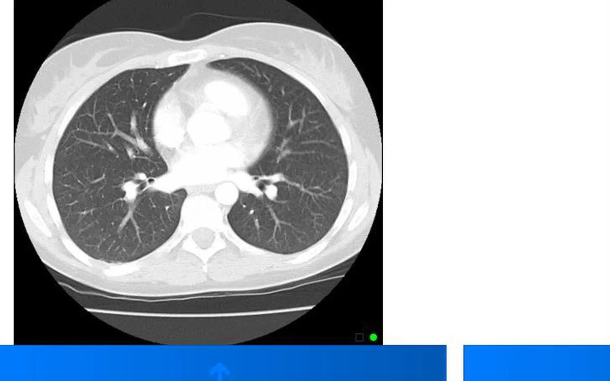 A chest CT scan selected for upload.