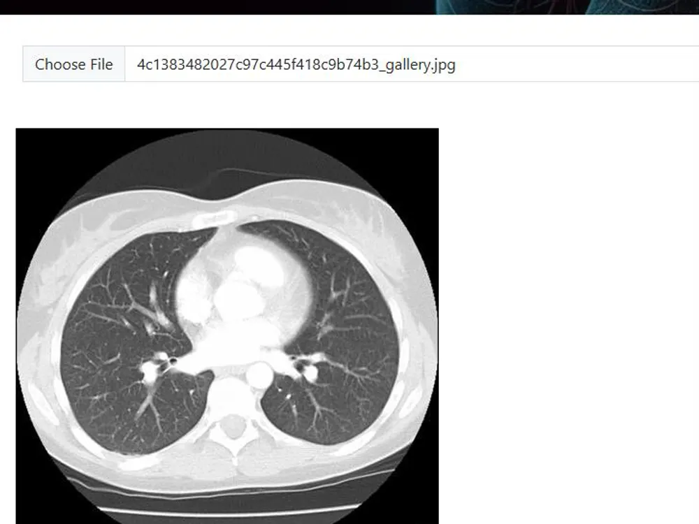 A chest CT scan selected in the detection system.